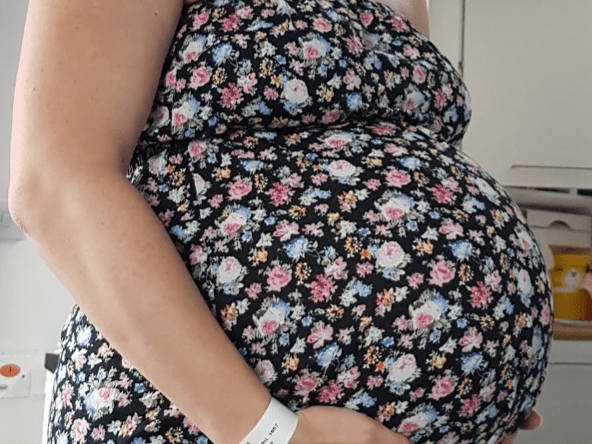 A Black and White image of a pregnant woman cradling her bump. She wears a floral dress and a hospital band